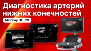 Артерии нижних конечностей: рутинное исследование на Mindray DC-90