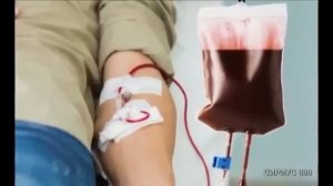 Кометы распыляют Газ.