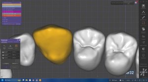 Коррекция позиции + тоннель