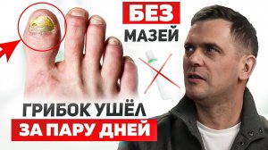 Вы не знали этой причины появления грибка ногтей! Психосоматика грибка на ногтях