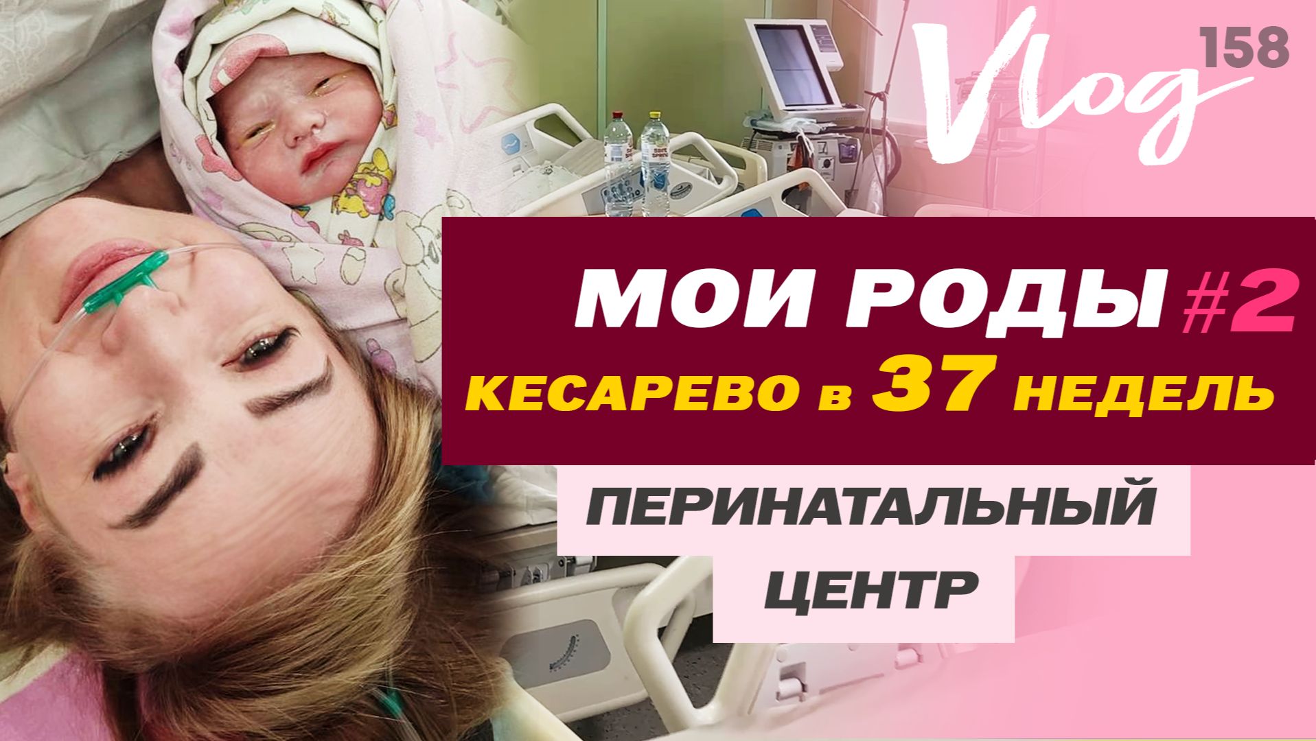 ЭКО. РОДЫ в 37 недель // часть 2//  Кесарево сечение // Перинатальный центр в Самаре