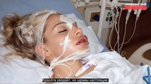 Инстаграмм запрещен в РФ согласно Закона.