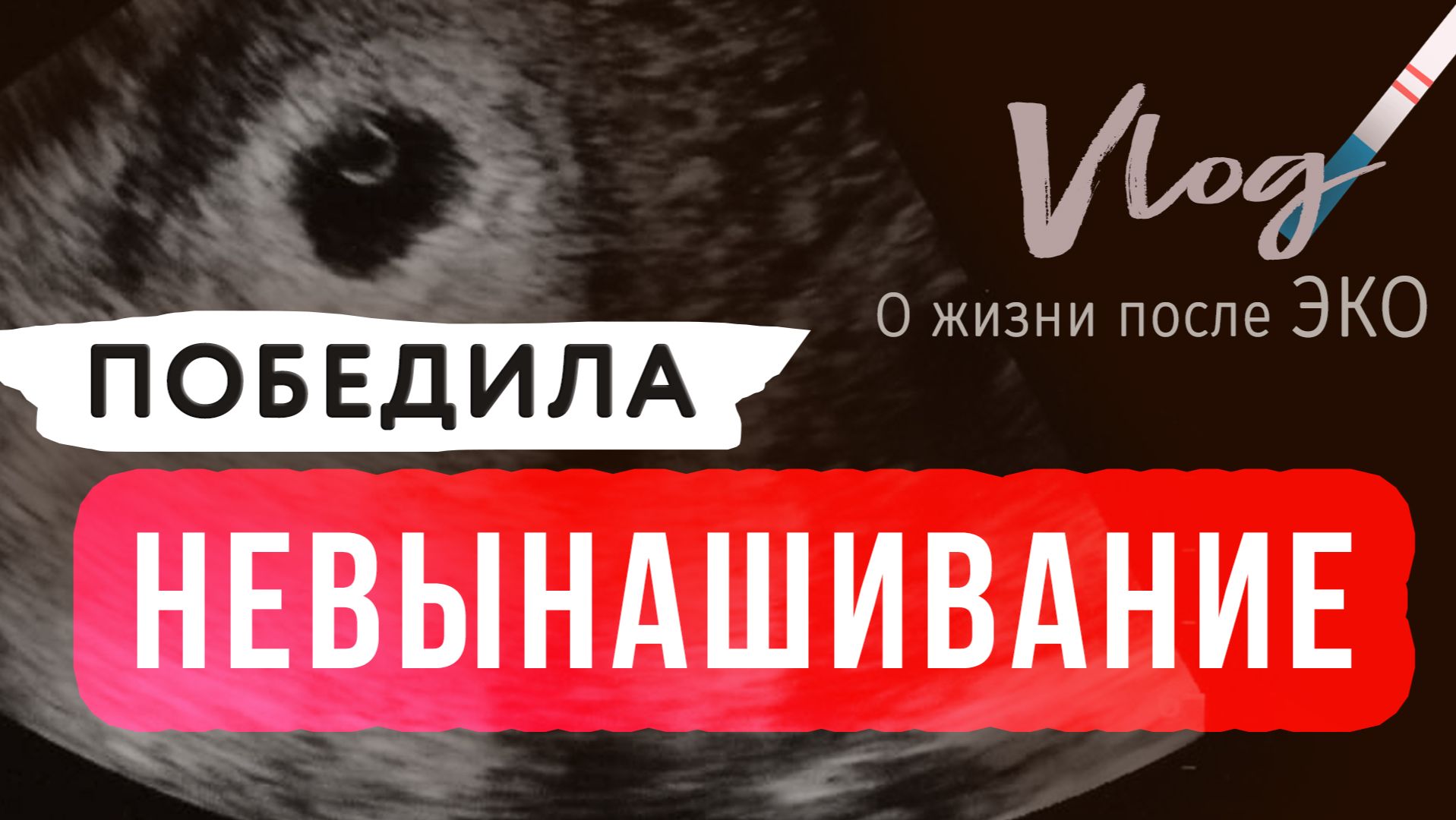 ЭКО || НЕВЫНАШИВАНИЕ || Терапия и мой опыт