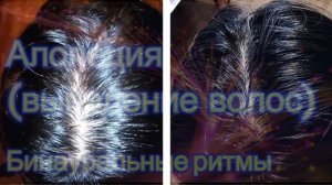 Алопеция (выпадение волос)*Бинауральные ритмы*Частота Райфа*Отрастите волосы