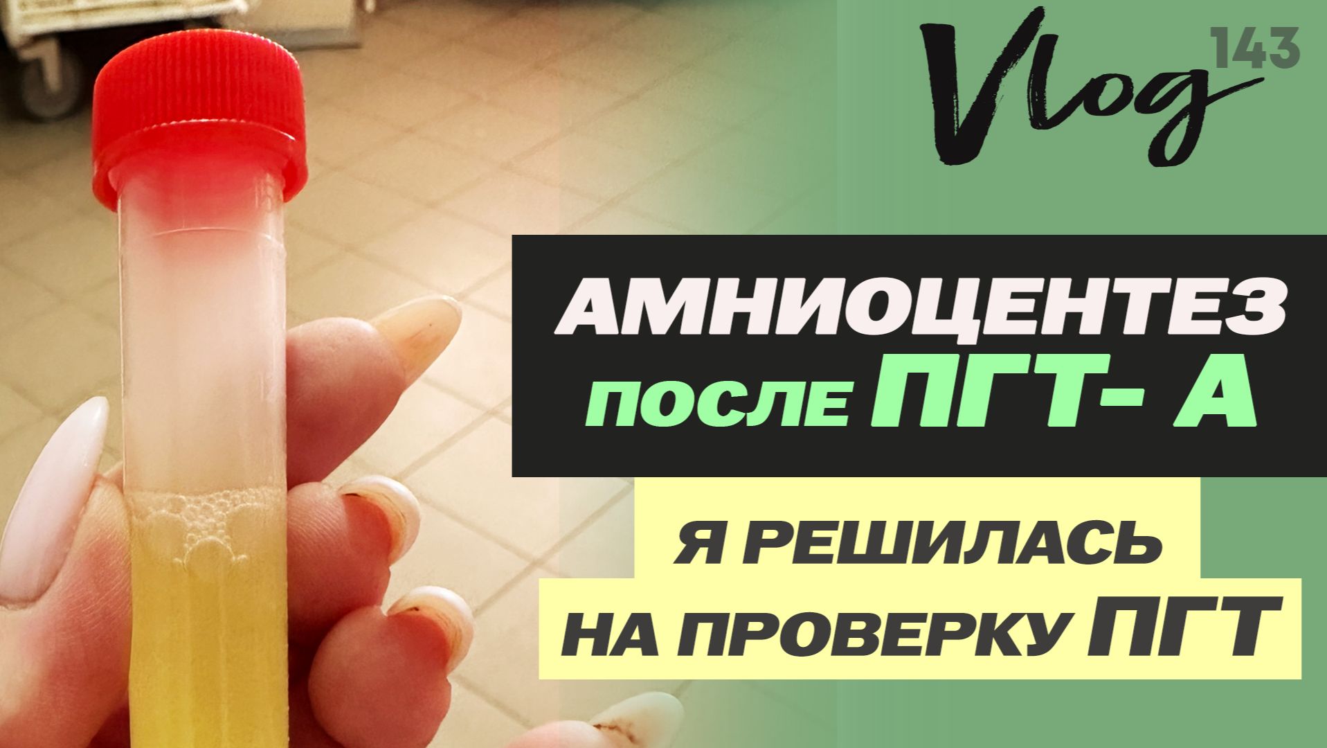 ЭКО. Амниоцентез после ПГТ // Виды инвазивной диагностики