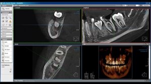 Видео работы томографа PointNix