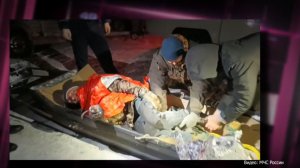 Лыжника с переломом ноги эвакуировали с Марчеканской сопки