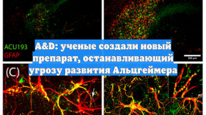 A&D: ученые создали новый препарат, останавливающий угрозу развития Альцгеймера
