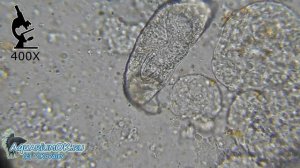 Гиродактилус роды. Живородящий моногенетический сосальщик.