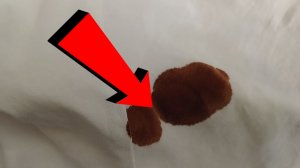 Как удалить йод с одежды За 3 Секунды!.