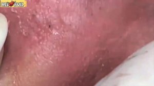 Глубокое очищение кожи. Успокаивающая косметическая процедура для снятия стресса #𝟗𝟎𝟎𝟑𝟓𝟕