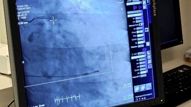 В 2025 году врачи центра сердечно-сосудистой хирургии провели 118 высокотехнологичных операций по за смотреть онлайн