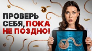 Скрытые признаки, что в вас живут ПАРАЗИТЫ! / Как проверить себя на паразитов?