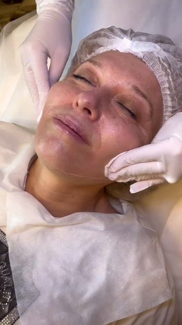 Фракционный фототермолиз эрбиевый лазер Dermablate