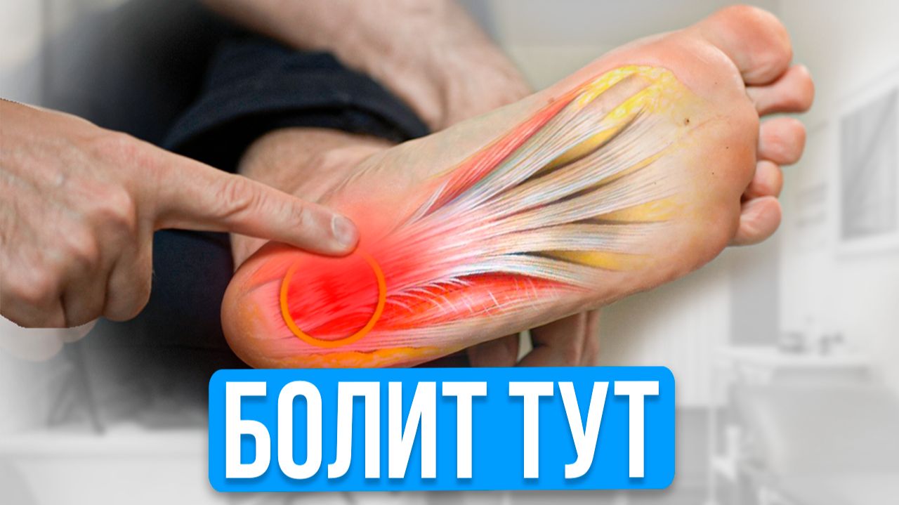 3 Простых Упражнения УБЕРУТ Боль в Пятке НАВСЕГДА! Делай по 1 минуте в ДЕНЬ! смотреть онлайн