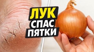 Трещины на пятках исчезнут за ночь! Обычный лук творит чудеса