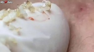 Глубокое очищение кожи. Успокаивающая косметическая процедура для снятия стресса #𝟗𝟎𝟎𝟑𝟔𝟗