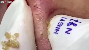 Глубокое очищение кожи. Успокаивающая косметическая процедура для снятия стресса #𝟗𝟎𝟎𝟑𝟕𝟎