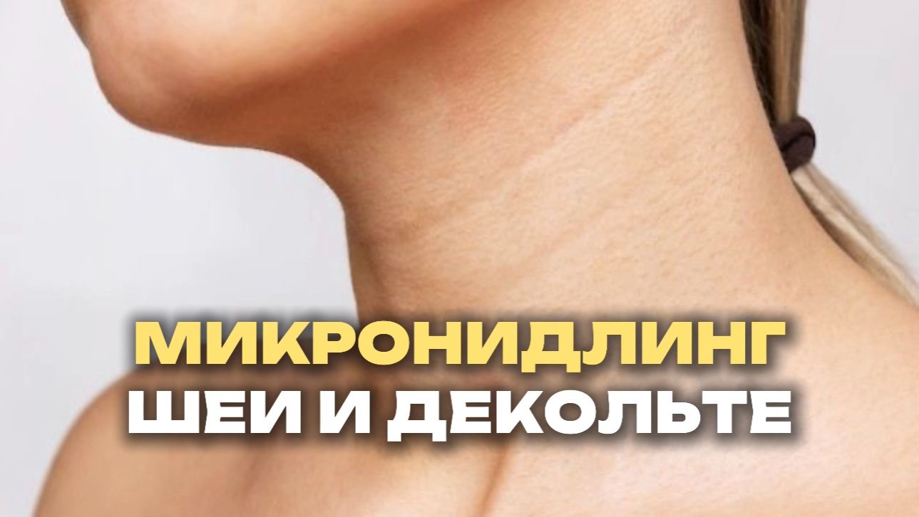 Микронидлинг шеи и декольте: как избавиться от морщин на шее