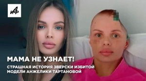 Мама не узнает! Страшная история зверски избитой модели Анжелики Тартановой