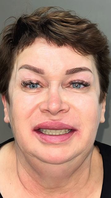 Кейс пациента