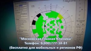 Компьютерная периметрия - определение полей зрения глаза