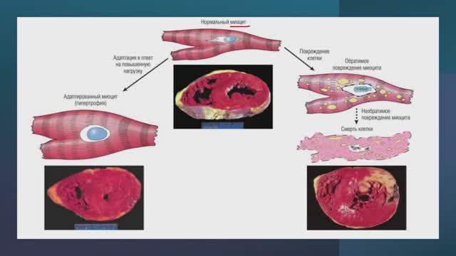 Механизмы клеточной адаптации. (Блок 2. Лекция 5)