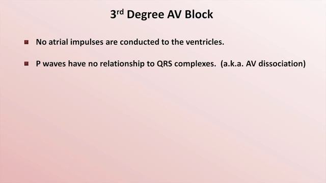 12 Intro to EKG Interpretation - AV Block  Eric Strong