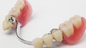 СУТКИ С ПРОТЕЗОМ!/ ПЛАНИРУЮ СТАВИТЬ ИМПЛАНТ/РАСПОКОВКА/