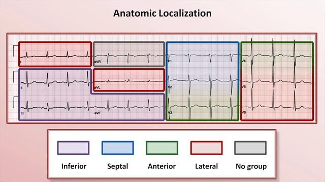 14 Intro to EKG Interpretation - Myocardial Infarctions (Part 1 of 2)  Eric Strong