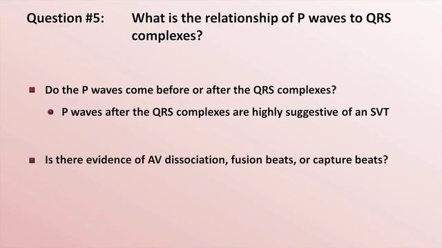 10 Intro to EKG Interpretation - How to Identify Any Tachyarrhythmia with 6 Easy Questions