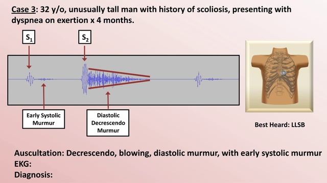 18 EKG and Heart Murmur Review - Part 1  Eric Strong