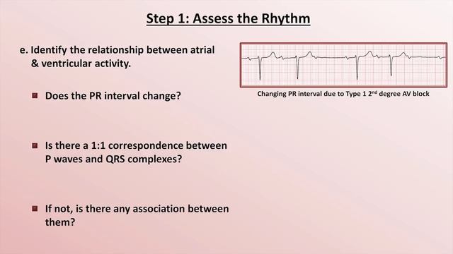 16 Intro to EKG Interpretation - A Systematic Approach  Eric Strong