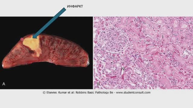 Обратимое повреждение клетки и некроз. (Блок 2. Лекция 2)