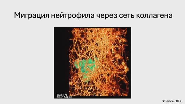 Острое воспаление - Часть 1. (Блок 3. Лекция 2)