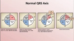 05 Intro to EKG Interpretation - Rate and Axis  Eric Strong