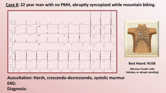 19 EKG and Heart Murmur Review - Part 2  Eric Strong