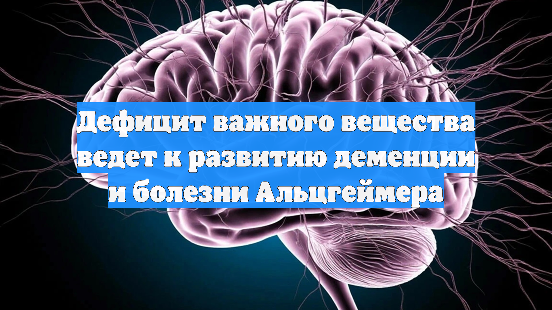 Дефицит важного вещества ведет к развитию деменции и болезни Альцгеймера смотреть онлайн