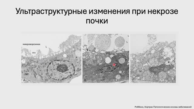 Обзор клеточных ответов на стресс и повреждение. (Блок 2. Лекция 1)