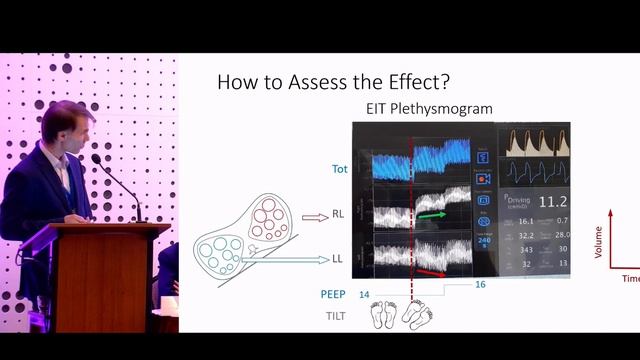LIVES PHYSIOLOGY 05.06.25 Gravity, body position and VQ matching - Mlček M.