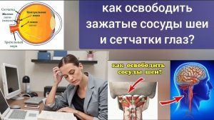 Мышцы атланта вредят сетчатке глаз. Трёхвекторное движение для шеи плюс упражнения для глаз