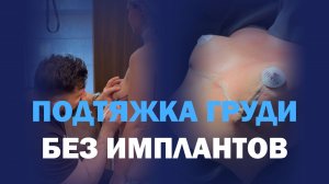 Якорная мастопексия у доктора Абозина: естественное обновление формы