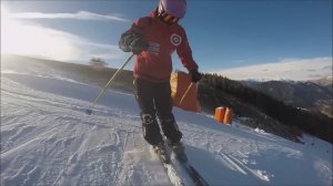 Ангуляция коленей