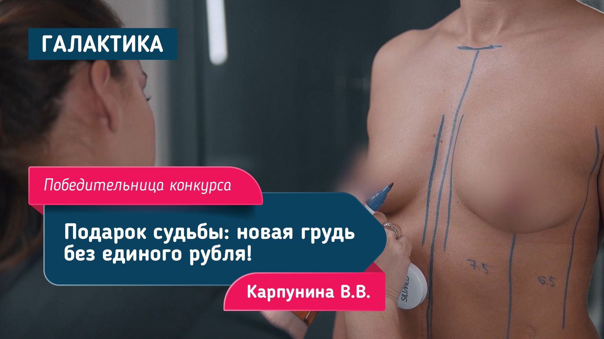 Маммопластика у Карпуниной — раскрываем нижний полюс | Подарок судьбы: новая грудь без единого рубля смотреть онлайн