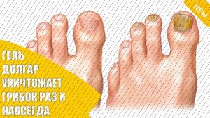 🎯 Грибок стопы мазь 999 инструкция по применению