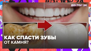 ПОЧЕМУ У ВАС БЫСТРО ОБРАЗУЕТСЯ ЗУБНОЙ КАМЕНЬ, А У ДРУГИХ НЕТ? | Доктор 24