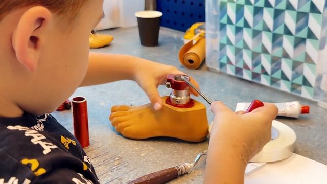 В 7 лет на протезе. Ребенок, который живет активной жиз? смотреть онлайн