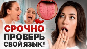 СРОЧНО проверь язык, возможно ты БОЛЕН! | Как по ЦВЕТУ языка оценить свое здоровье?
