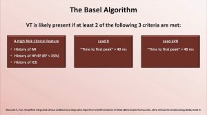 23 Advanced EKGs - Ventricular Tachycardia (Classification & Localization)