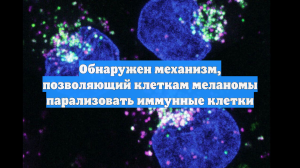 Обнаружен механизм, позволяющий меланоме «отключать» иммунные клетки
